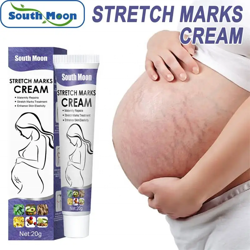 South Moon Stretch Mark Removal Cream