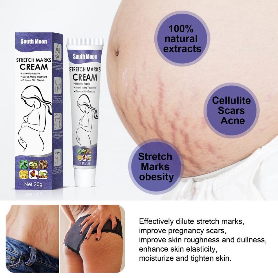 South Moon Stretch Mark Removal Cream