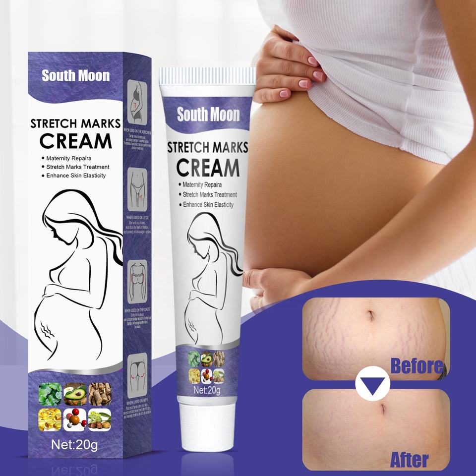 South Moon Stretch Mark Removal Cream
