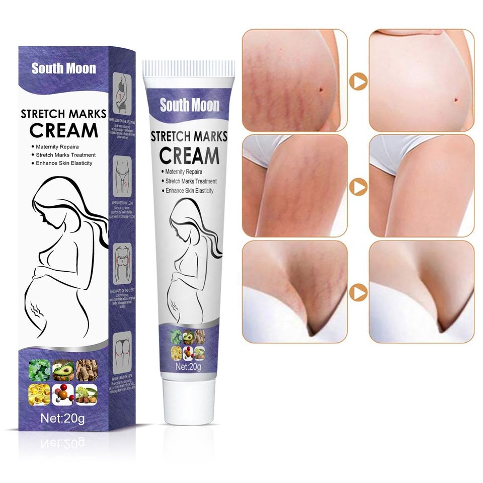 South Moon Stretch Mark Removal Cream