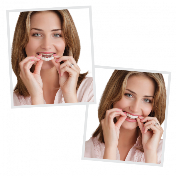1 Pair Snap on Teeth Veneers for Men and Women